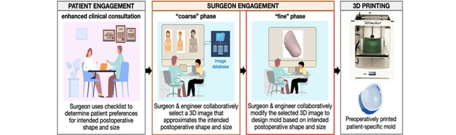 breast-surgery-process-wide.jpg