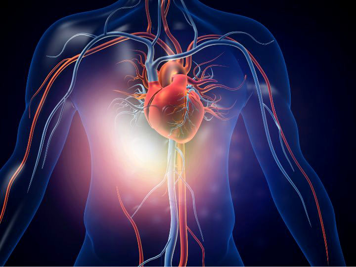 Heart Disease