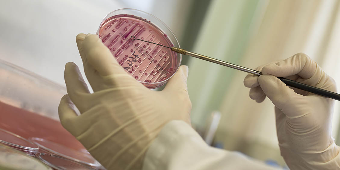 gloved hands preparing microbial culture